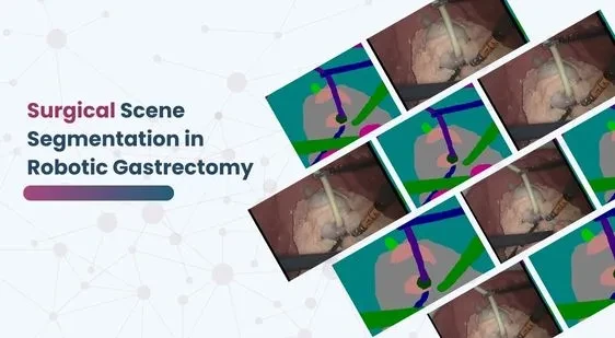 Surgical Scene Segmentation in Robotic Gastrectomy (1)