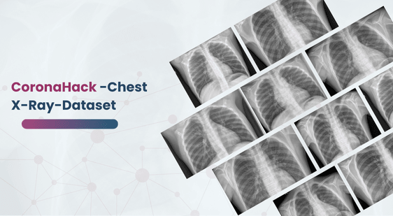 CoronaHack -Chest X-Ray-Dataset